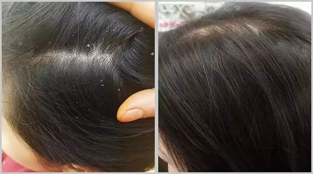 德国旱金莲迷迭香洗发皂,德国何首乌洗发皂