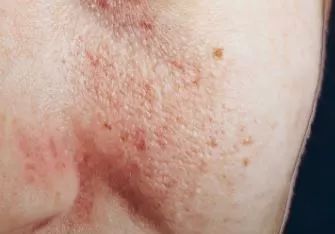 防晒敏感肌专用正品,十大公认敏感肌好用的防晒