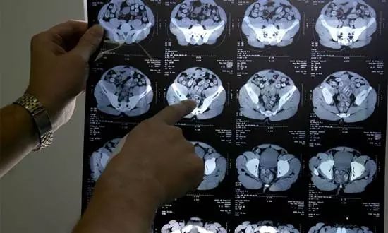 吸毒的后果有多大看完你就知道了,吸毒者持有毒品怎么定性