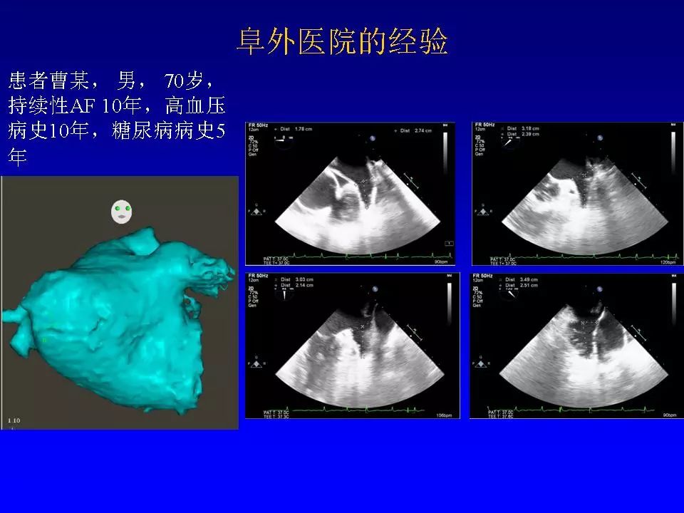 方丕华医生在哪个医院出诊,阜外方丕华出诊时间