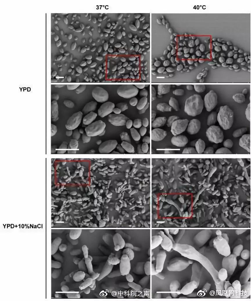 超级真菌爆发死亡率,超级细菌真菌致死率