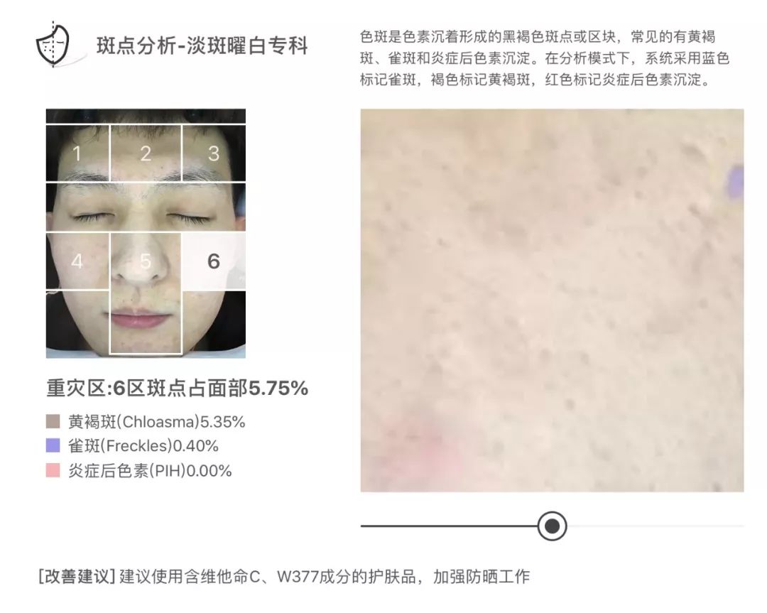 灏忚寕鑲岃瘖瀹よˉ姘村悧,灏忚寕鑲岃瘖瀹ゅ埌搴曟湁澶氬己