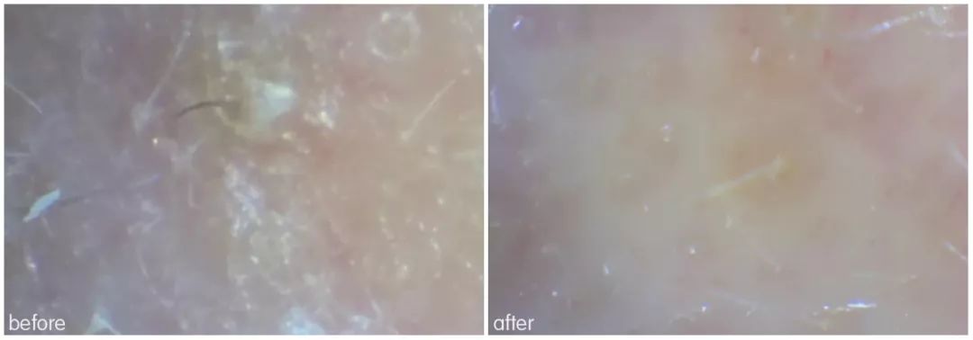 灏忚寕鑲岃瘖瀹ゅ埌搴曟湁澶氬己,灏忚寕鑲岃瘖瀹よˉ姘村悧