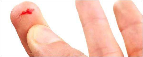 手指被纸划破为什么那么痛,手指头被割伤很深一个口子