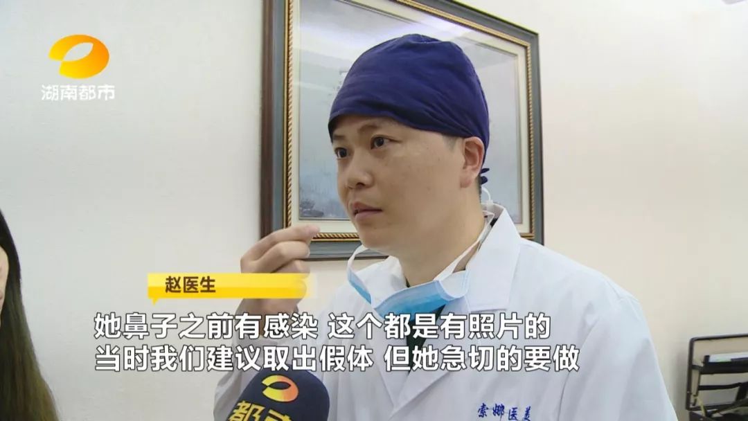 长沙女子花了两万八整容,长沙女子花了2万8整容