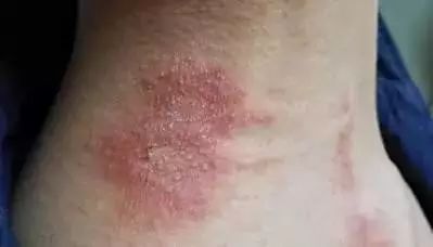 信阳市虫子,信阳常见的虫子