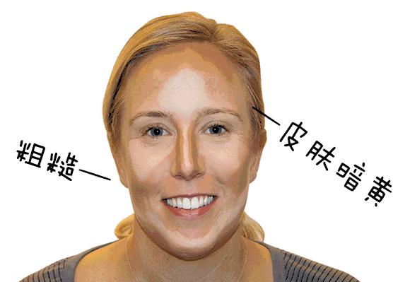 小茂肌诊室∣为什么拼命补水好多年,皮肤还是没变好?