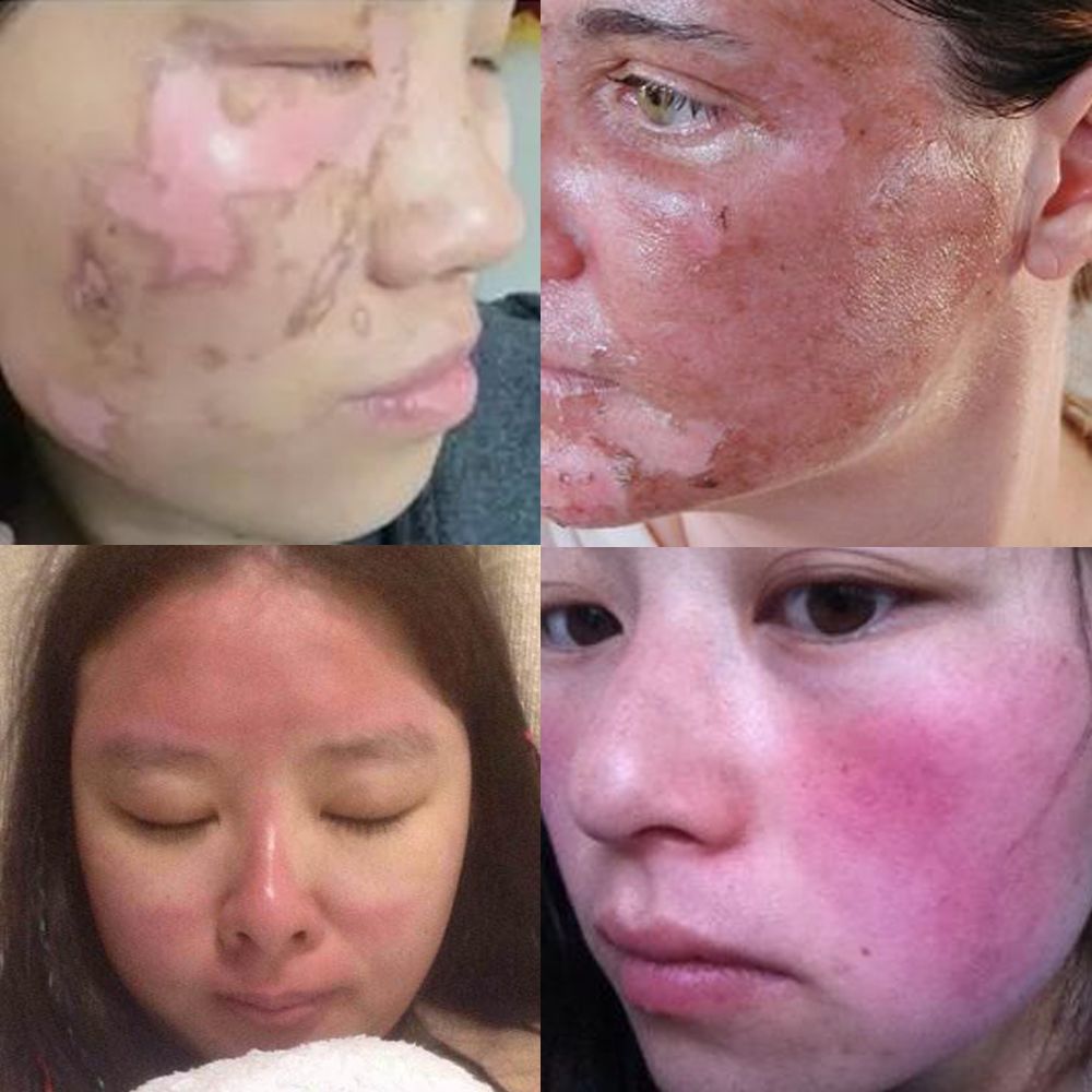 大s日本防晒帽哪个颜色好看,大s同款渔夫防晒帽