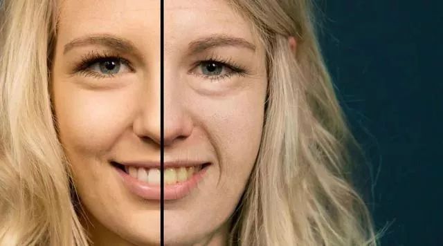 团购|堪称地表最强防晒,法国滑雪队都在用!