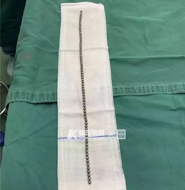 丁丁里塞进了70颗*珠钢**!家长们都该了解一下“儿童*慰自**”……