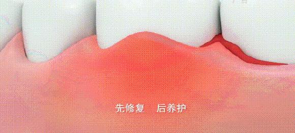 团购|俄罗斯亮白牙膏组合，轻松瓦解多年牙垢，清新口气告别黄牙