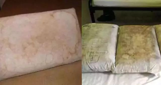 不用洗床单晒被子怎么除螨虫,螨虫去除妙招不用花露水