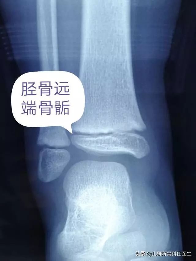 儿研所儿童生长发育门诊看什么,儿研所看孩子生长发育挂哪个科