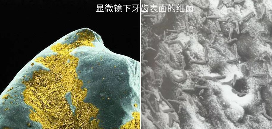 3秒清新口气口腔持久留香,3秒永久去除口臭