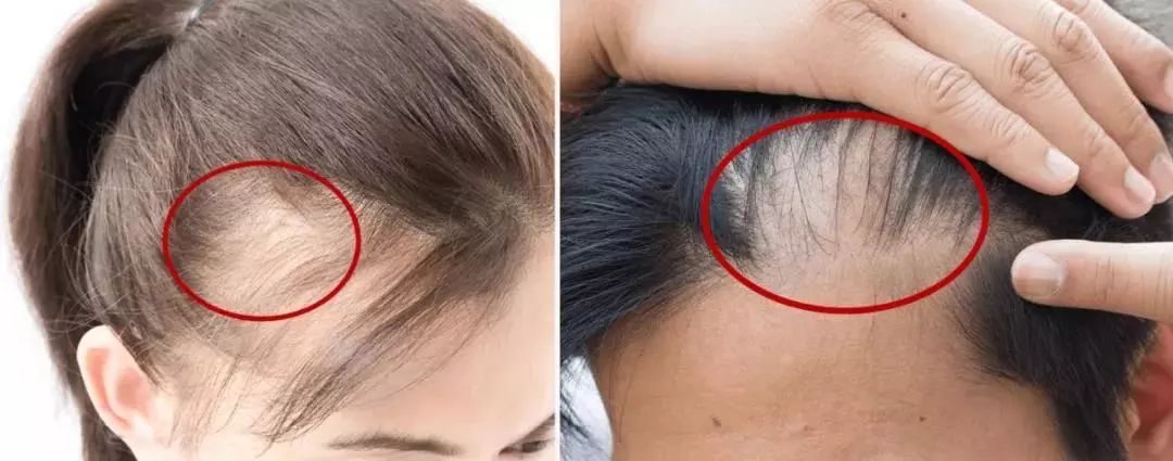 超短发细软塌怎么打理,拯救发量理发