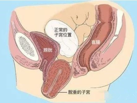 产后ella自曝后遗症,ella自曝产后