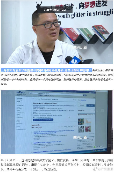 婴儿头上少一块皮肤,婴儿头上少块皮肤