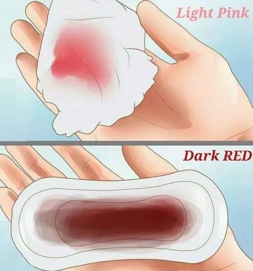 医生：警惕月经异常隐藏疾病信号,月经小常识医学科普