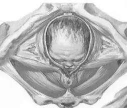 关爱女性盆底健康课程,关爱女性盆底健康讲座