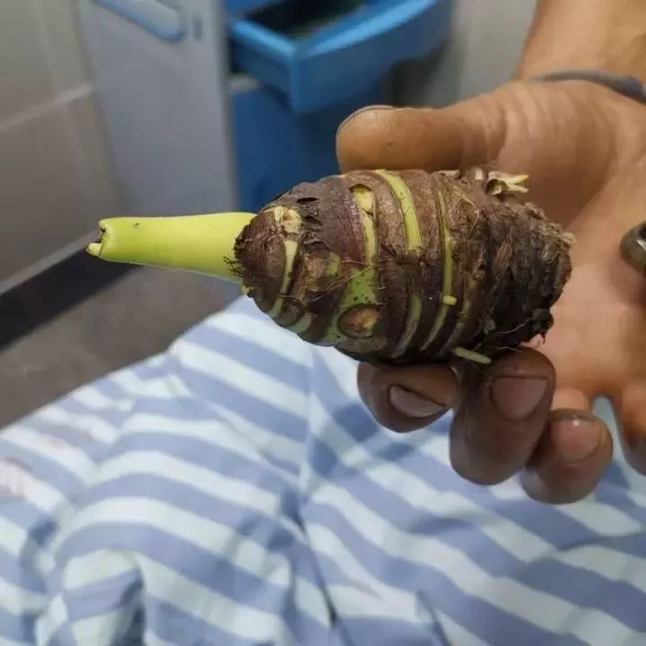 误食毒物最有效的急救方法,紧急提醒最新中毒案例