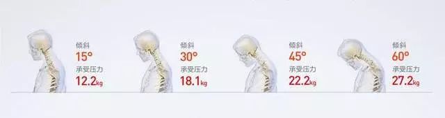 电脑颈椎支架推荐,护颈椎笔记本电脑支架