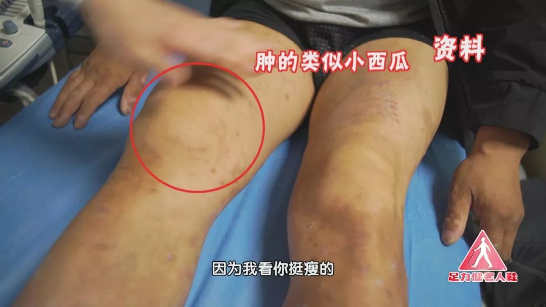 养生堂今日节目,养生堂营养对抗疾病视频