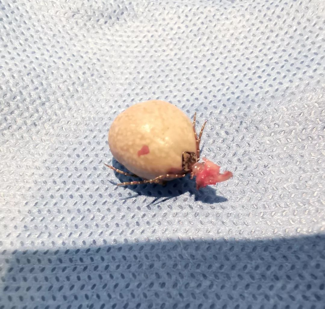 成人肚脐眼凸起肉球严重吗,成人肚脐眼凸起肉球治疗全过程