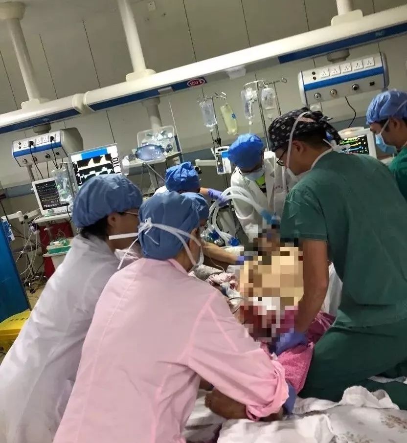 全身的血换了一半！4小时生死救援，佛山二宝妈妈最快周日出院