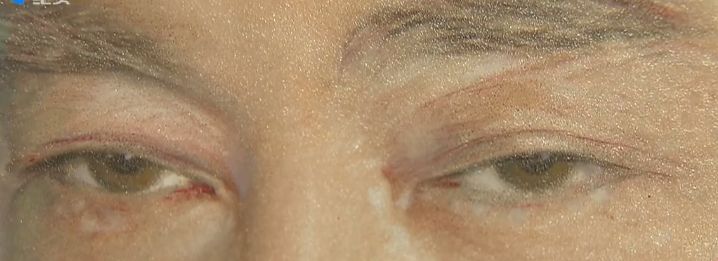 p图去眼袋,p图大师去眼袋