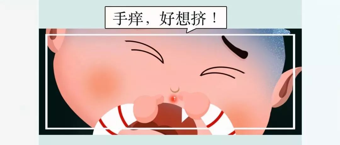 三角区的痘痘千万不要碰,三角区祛痘科普