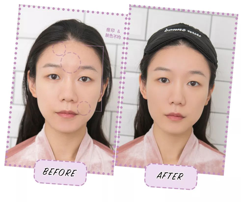 拯救夏日微瑕皮girl，请收下这份高能科普