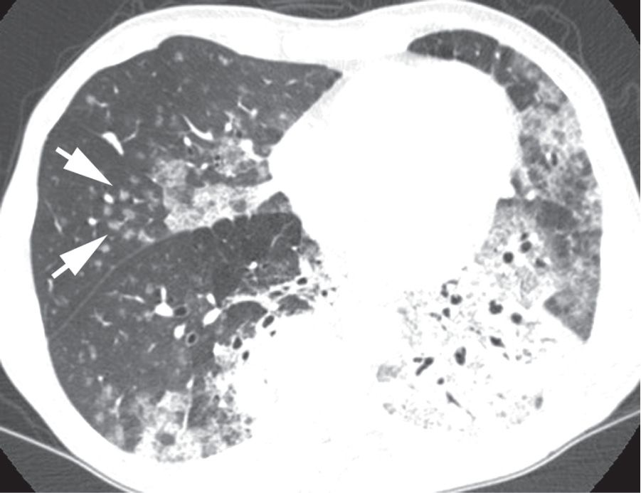 认识肺部的目的,认识呼吸器官知识点