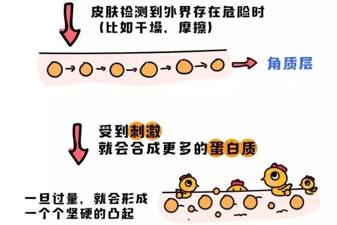 鸡皮肤永久消除,37天快速祛鸡皮肤