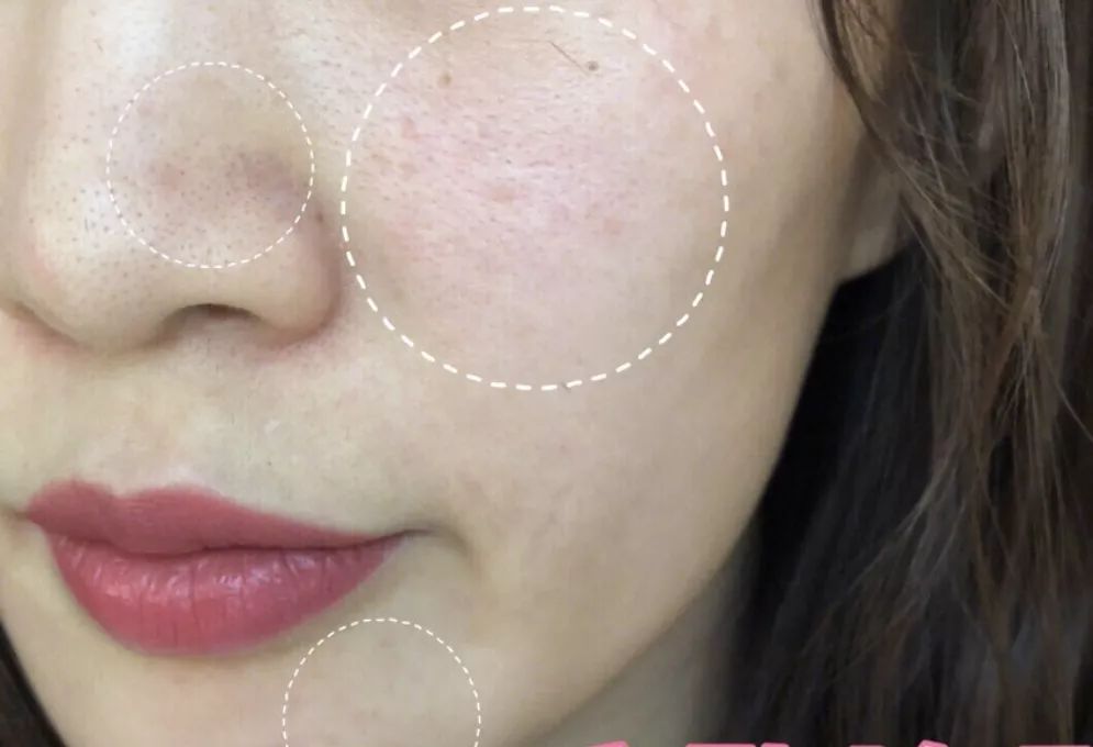 有必要用哪一款水乳,一辈子就能用一套水乳