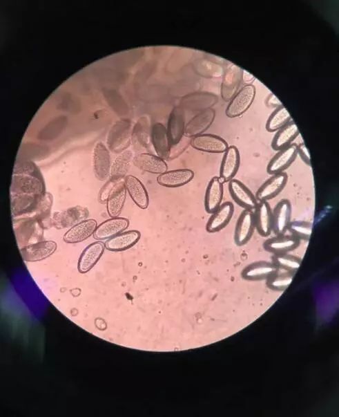 4岁小女孩屁屁痒,妈妈脱下裤子检查后吓坏了:一粒粒竟还会动