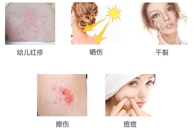 芦荟胶补水保湿提亮肤色晒后修复,万能芦荟胶补水美白修复敏感肌