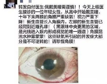 “日本制造”又曝丑闻!违禁成分泛滥,却还有1亿中国人疯抢