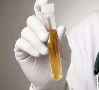 女性老年反复尿路感染最佳方案,女性反复尿路感染和肾有关系吗