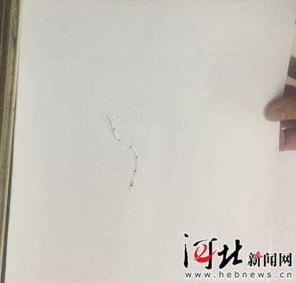 保定市定兴县医院无证麻醉师致导管遗留患者苦不堪言