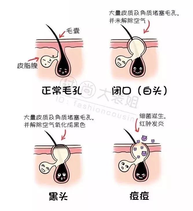 拜托女孩子这个部位千万不能黑！实在太尴尬了