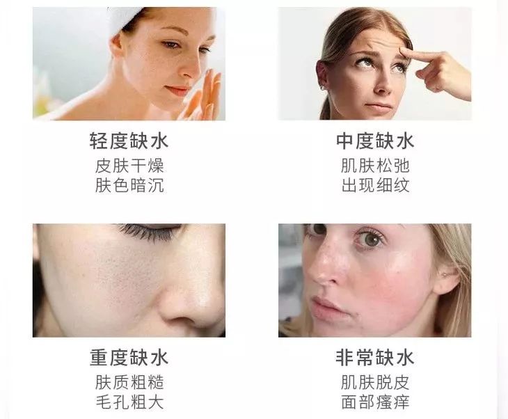 护肤水保湿补水正品大瓶直播,护肤水团购