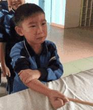 胳膊上的疤痕是怎样形成的,手臂上哪里的疤不容易被发现