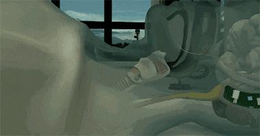 打呼噜其实是一种病,打呼噜是一种病吗有药可治吗