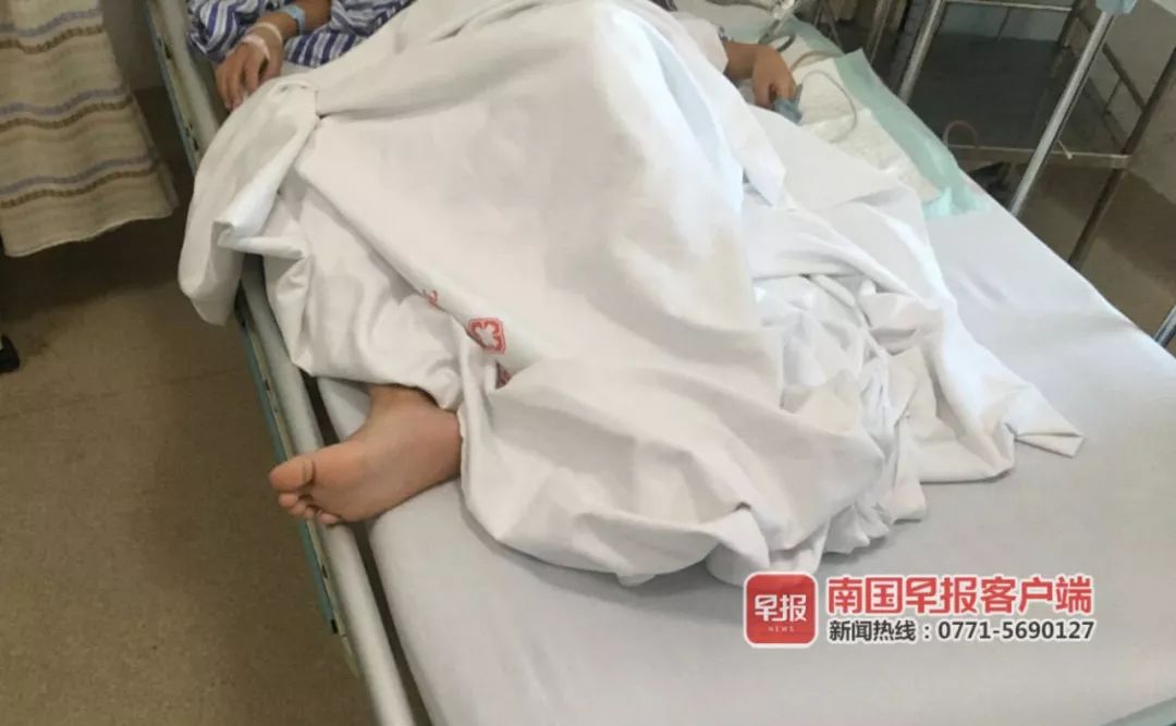 吓人！11岁男孩在家中玩耍，竟将一根4.5厘米长缝衣针塞入*体下**