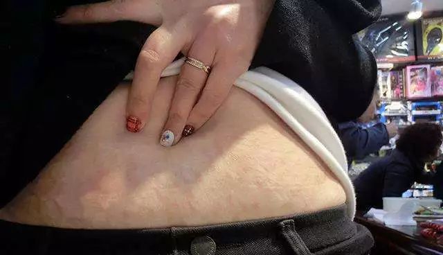 肚皮松弛怎么运动紧致瘦肚子,减肥后肚皮松弛怎样才能收紧