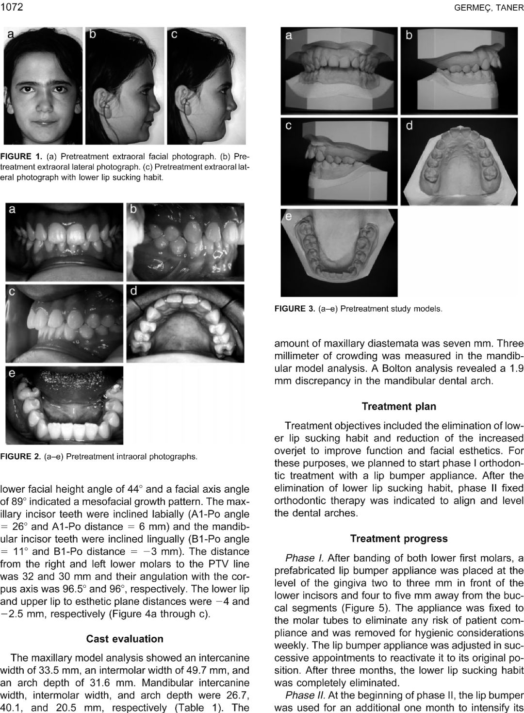 孩子吸吮能力差怎么办,儿童吸吮手指原因及治疗方法