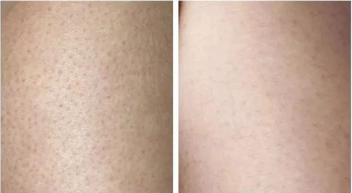 givenchy折扣,givenchy1折