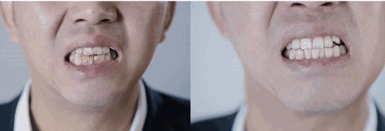 牙龈上火、红肿，还口臭？香港人用了91年的中药牙膏，消炎抑菌，让你刷出一口健康好牙