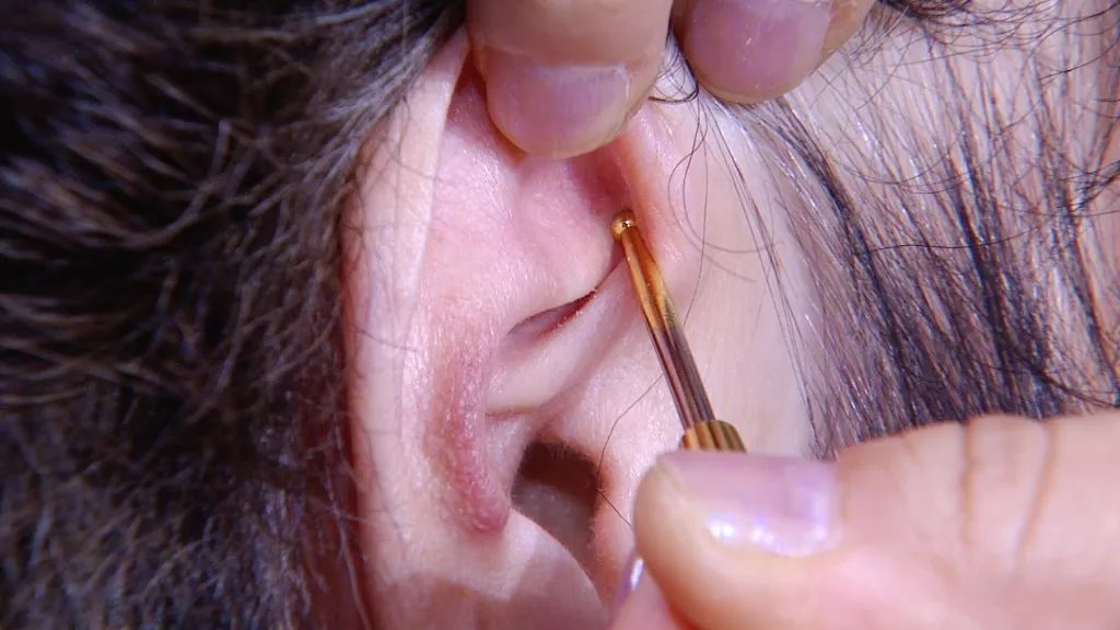 「养生堂」今日17:25播出《外治祛疾有妙法——耳穴疗法》