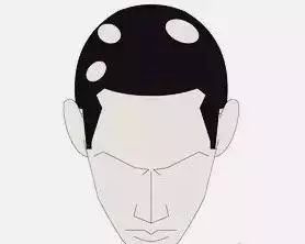 鬼剃头也没什么好治疗的方法,农村给人驱鬼办法有哪些